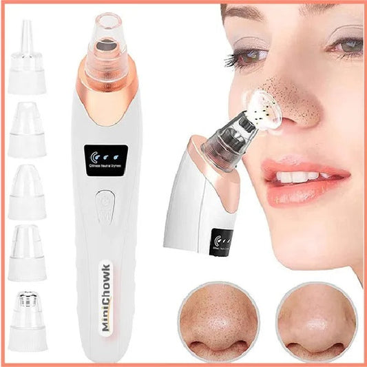 Derma Suction – Blackhead Remover with Vacuum Action -Pore Cleaning Device