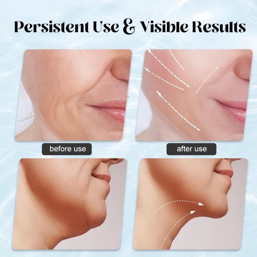 3 in 1 LED Face & Neck Massager – Anti-Wrinkle Skin Tightening Tool